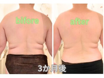 ヨサパーク カズリー(YOSA PARK kazury)/ルルオン3ヶ月の結果!