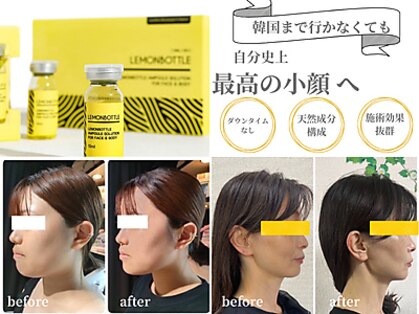 愛 まぁるの写真