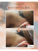 ビューティサロン ベルティア(Beltia)/#脱毛#ダイエット#ブライダル
