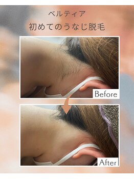 ビューティサロン ベルティア(Beltia)/#脱毛#ダイエット#ブライダル