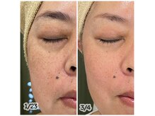 ポノ(pono)の雰囲気(シミシワお顔のたるみ一挙改善 肌育コース4ヶ月集中プログラム)