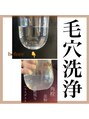 サンカリビューティー(SANKARI beauty)&nbsp;毛穴洗浄で目で見て確かめて！肌の落としきれてない汚れ！