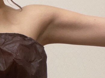 アーネラミーナ(Anela mina)の写真/【いつでも大人気】二の腕の太さで華奢は作れます◎