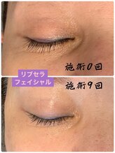 プリュネル(Prunelle)/プラズマシャワー