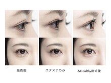 エネル バイ アルト(eneru by arto)/＆healthy &nbsp;