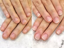 リファーレ(RIFARE)の雰囲気（当日からあこがれの縦長爪♪半年後には自爪でも見せたい指先へ◎）