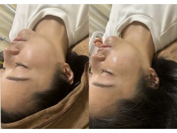 マホロバ セカンド(mahoroba 2nd)/ララピールで艶肌