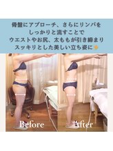 エルバード/骨格整えてリンパを流す！