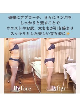 エルバード/骨格整えてリンパを流す！