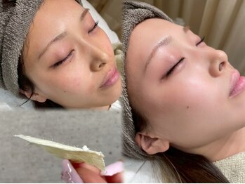 ユーアイ(Yu_eye)の写真/《ツヤ肌WAX脱毛★全顔1回¥6000~》明るく均一な肌トーンで素肌に自信を＊お得な眉WAXとのSETメニューも◎