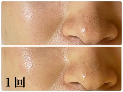 ルマエクレ(rmaecla)の写真