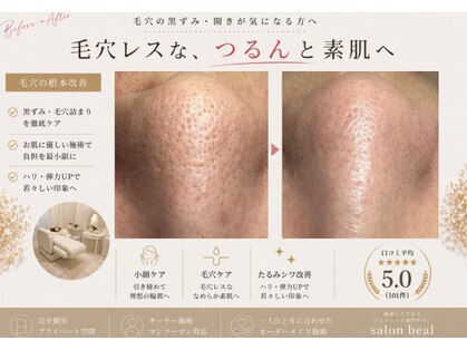 ベアール(beal)の写真