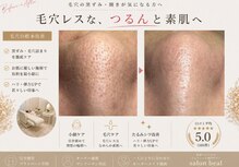 ベアール(beal)