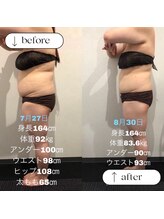 トータルビューティーサロンリア(Li'a)/ビフォー＆アフター