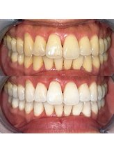 ライトビューティー 池袋店(LightBeauty)/症例写真