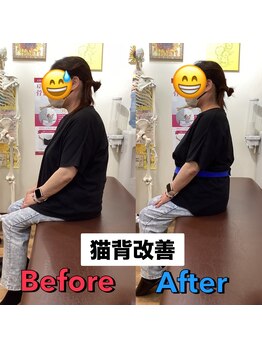 ヒデ整体院(Hide整体院)/猫背矯正骨盤矯正B/A肩こり腰痛