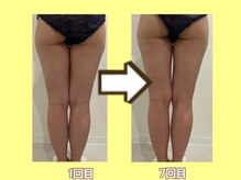 ビオール 池袋店(beall)/大人気！オーダーメイド痩身90分