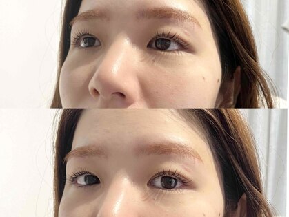 エレミ(ELEMI)の写真