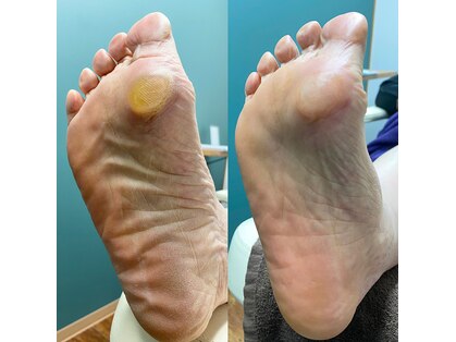 足のトラブルセンター 狸小路店の写真