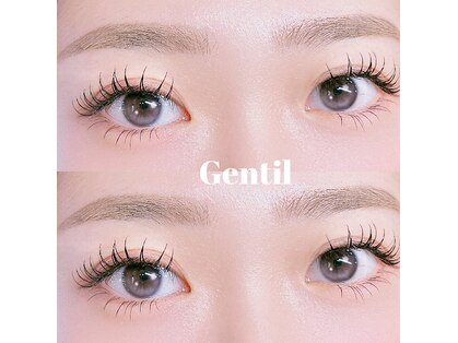 ジャンティ(Gentil)の写真