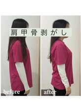 ギャラクシービューティー(galaxy beauty)/肩甲骨はがし