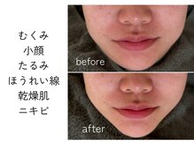 ほねつぎ一休さん 宇品店の雰囲気（最新機器で美肌・ダイエットから体の不調まで解消！）