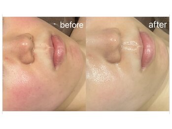 シェリー(Cherie)の写真/完全個室で極上の癒し時間を堪能。肌質改善を二人三脚でサポートし、安心継続できるプライベートサロン◎