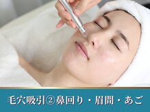 シャルトルズ 西宮北口店/吸引　２