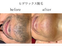 サロン ド アピール(salon de APPEAL)/