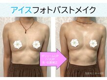 ブロッサム(BLOSSOM)/アイスフォトバストメイク