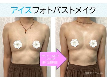 ブロッサム(BLOSSOM)/アイスフォトバストメイク