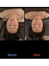 キヅク/before→afterお顔の整体