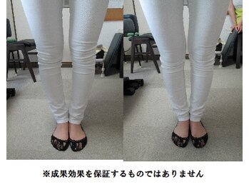 健康ケアセンター/0脚矯正 骨盤矯正