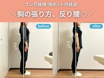 整体院カイト/【20代ブライダル】before/after