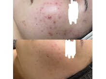 ワレア(Walea)の雰囲気（繰り返す肌のお悩みを、本格的な韓国肌管理でケアしませんか？）