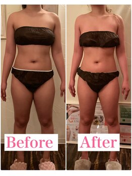 トータルビューティーサロン 凛/食事制限できなくても