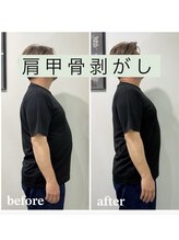 ギャラクシービューティー(galaxy beauty)/肩甲骨はがし