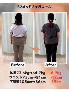 くさば整骨院/32歳女性/ダイエット3か月コース