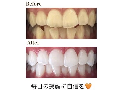 ホワイトニングショップ 恵比寿店の写真