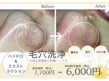ビオエル(Bee'oele)の雰囲気（当店の毛穴洗浄は水を使わず、美容液で毛穴洗浄をおこないます◎）