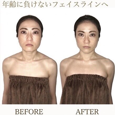 小顔整体研究所 KSラボ 藤が丘店｜ホットペッパービューティー