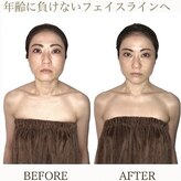 小顔整体研究所 KSラボ 藤が丘店