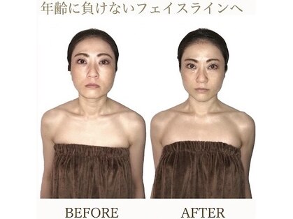 小顔整体研究所 KSラボ 藤が丘店の写真