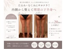 ヨサパーク ブルーチェリー(YOSA PARK Blue Cherry)の雰囲気（落ちにくい太ももの脂肪やセルライトにも効果絶大◎）
