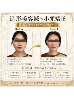 エモシオン トウキョウ(EMOTION TOKYO)/造形美容鍼×小顔矯正