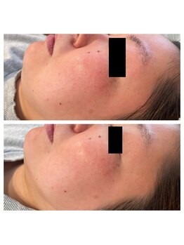 シェリモ(CHERIMO)/スーパーフードワックス