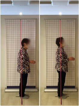 越谷KAJI整体院/肩こり、姿勢改善