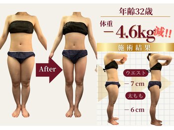 ザ ラウラ ビューティー ボディ(THE LAULA BEAUTY)/32歳【全身痩せ】
