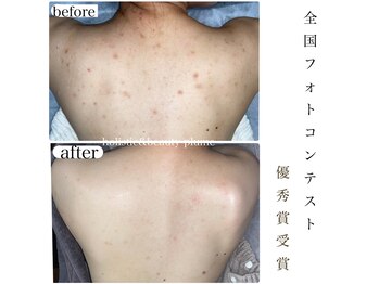 ホリスティックアンドビューティー プリュム(plume)