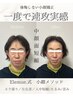 【とにかくたるみ集中☆】数年前のシャープな自分へ☆小顔リフトアップコース